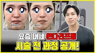 요즘 대세 리프팅레이저 온다리프팅 시술후기! 효과, 유지기간, 통증, 전후사진, 천호온다리프팅