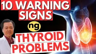 10 Warning Signs ng Thyroid Problems. - By Doc Willie Ong (Internist and Cardiologist)