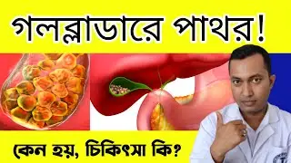 গলব্লাডারে পাথর কেন হয়| gallbladder bladder stone|
