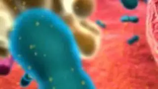 Chrons disease with hebrew subtitles