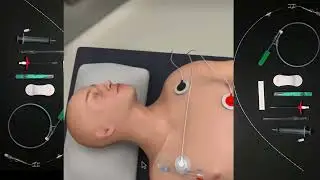 Central Venous Catheterization - Central Line Insertion Basic Skills 3D Animation