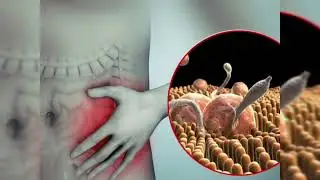 Балаңыздың ішінде паразиттер болса #Глисты #паразиты