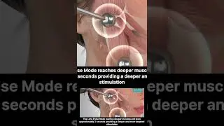 EVE Facial 14: EMS #3