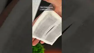 Новокаин как применять методом электрофореза (часть 2) 