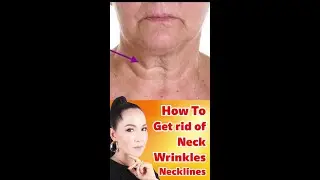 (Shorts) How to get rid of neck wrinkles, neckline & sagging | WATCH FULL VIDEO in Description