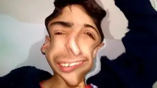 COMO FAZER O EFEITO DISTORCIDO NO VÍDEO PELO CELULAR