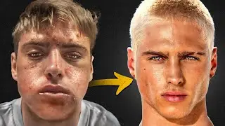 MY VIRAL LOOKSMAXXING TRANSFORMATION (EXPLAINED)