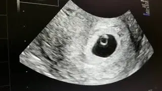 6 Week Ultrasound/ Heartbeat!!