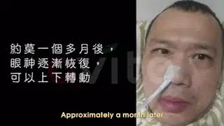 Mao Mao - Celergen Help My Husband With Stroke