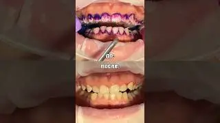 КРАСИМ ЗУБЫ ИНДИКАТОРОМ НАЛЁТА 😱🦷 #shorts
