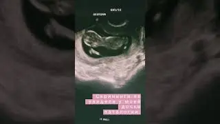 История солнечной девочки Лисёны.