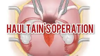 HAULTAIN'S OPERATION|Womens Surgery|knowledge Madnoob