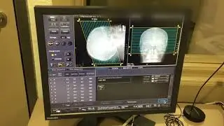 Lectura digital TAC. Técnico Superior en Imagen para el Diagnóstico