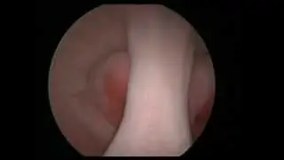 Art of vaginoscopy by osama shawki, septum vagina, cx and uterus