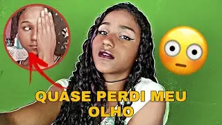 O DIA QUE EU SOFRI UM ACIDENTE E QUASE PERDI MEU OLHO +MAQUIA E FALA🌺💜