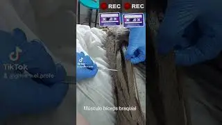 El músculo bíceps braquial