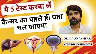 5 SIMPLE BLOOD TESTS TO DETECT CANCER - 2025 UPDATES • DR. DAUD AKHTAR (MD PATHOLOGIST)