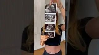 Baby on Board 🍼🤭🤰🧿 #babyonbaby #bebek #baby