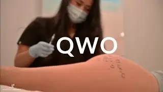QWO Cellulite Removal at Honolulu MedSpa