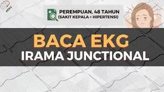 BACA EKG (IRAMA JUNCTIONAL) | EP.8