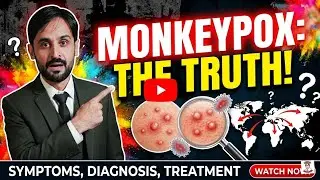 Monkeypox | Monkeypox Disease | Monkeypox Symptoms