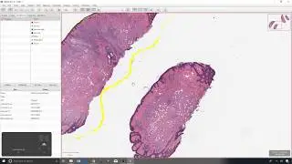 4 - Simple annotations