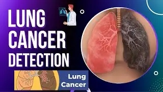 Lung Cancer Detection System using Machine Learning