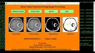 Python Code for Brain Tumor Detection Using CNN Final Year Project    Biomedical Project
