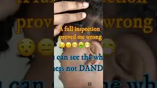 Me thinking I can pull off 5 MONTHS of NOT WASHING my hair then I saw THIIIIIIS😱🤮😨