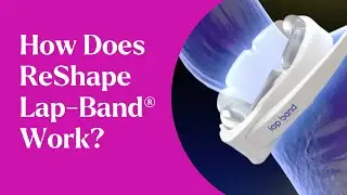 How Does the ReShape Lap-Band® Work?