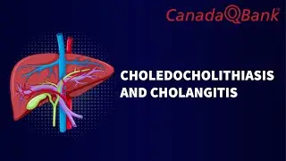 Choledocholithiasis & Cholangitis Explained | Biliary Tract Disorders | CanadaQBank
