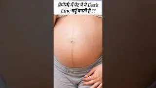 Pregnancy मे नाभि line कयूं बनती है #shorts #nabhiline #lineanigra #pregnancysymptoms #pregnantbelly
