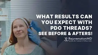 Are PDO Threads Worth It?