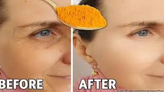 Turmeric and Honey Anti-Aging Mask | Natural Collagen Booster for Youthful Skin