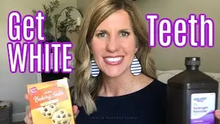 HOW TO WHITEN TEETH NATURALLY!  Top 4 Tricks in Minutes