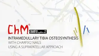 Intramedullary tibia osteosynthesis with CHARFIX2 nails using a suprapatellar approach