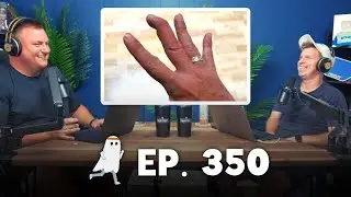 Living with Mallet Finger (Ep. 350)