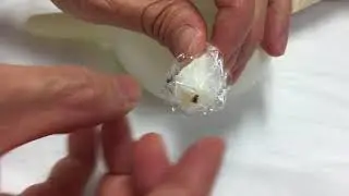 How to apply anaesthestic cream before circumcision baby & adult circumcision