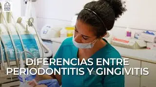 ¿Cuál es la diferencia entre periodontitis y gingivitis?