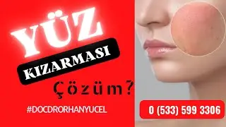 IS THERE A SOLUTION FOR FACE REDNESS?