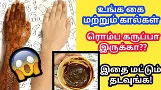 11.உங்க கை மற்றும் கால் மட்டும் கருப்பா இருக்கா??இதை தடவுங்கள்!!MAGICAL MASK FOR SUNTAN