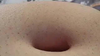 Loud Full Belly Sounds (No Mic!)