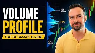 The ULTIMATE Volume Profile Guide (Setups, Entries, TP/SL)