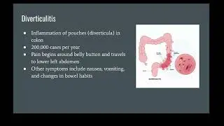 Ultrasound for Gastrointestinal Diseases