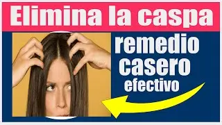Remedio contra la caspa, remedio casero efectivo.¡Adiós Caspa.