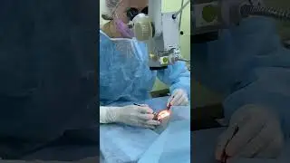 Операция по замене хрусталика, лечение катаракты, cataract surgery