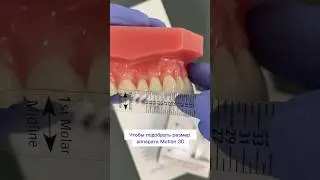 Как подобрать размер аппарата Carriere Motion 3D? #ортодонтия #брекеты #orthodontist