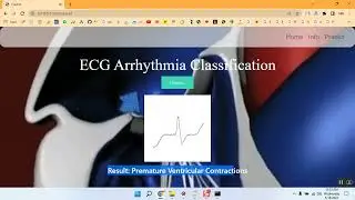 ANNet A Lightweight Neural Network for ECG Anomaly Detection in IoT Edge Sensors all