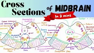 MIDBRAIN - Cross Sections in 3 minutes! | Dr.AI