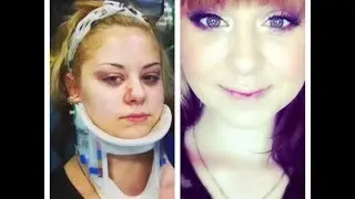 GRWM: After my car crash